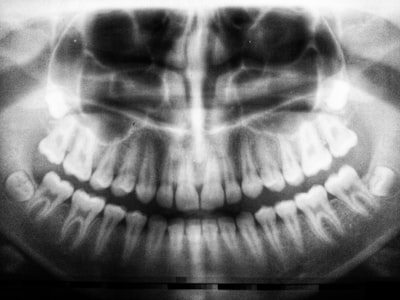 Cómo adaptar DINO para diagnóstico por imagen médica