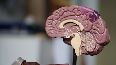Comparativa de métodos para diagnóstico cognitivo dinámico