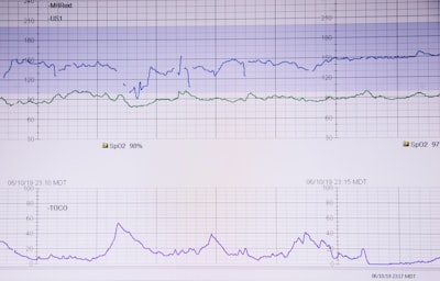 Detección de estrés prenatal con ECG y aprendizaje auto-supervisado