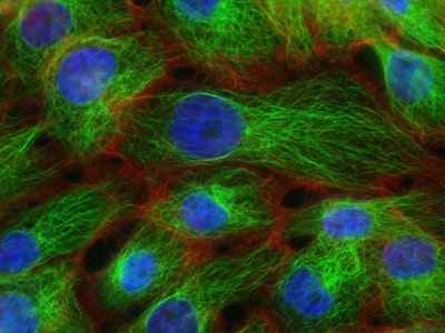 BioBlobs: Descubrimiento no supervisado de subestructuras funcionales para predicción de proteínas