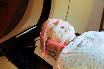 Automatización del ajuste externo en radioterapia con IA