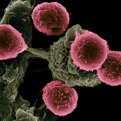 Estafa médica: dióxido de cloro como supuesta cura del cáncer