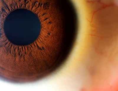 IA interpretable para detección temprana de glaucoma