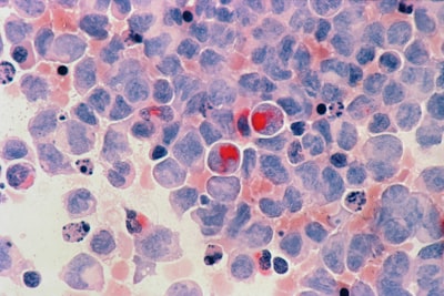 El poder diagnóstico del color en la clasificación del cáncer