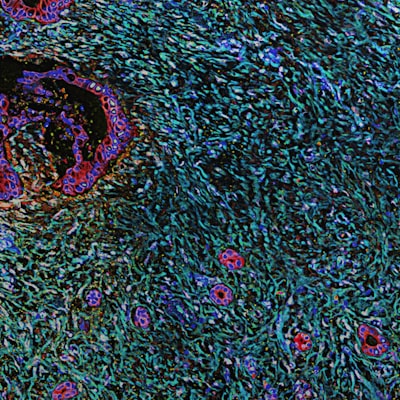 La percepción supera a la navegación en microscopía autónoma