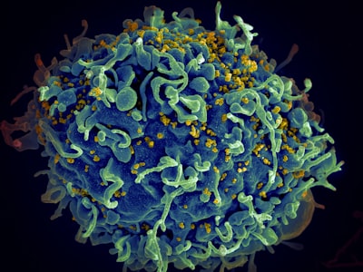 SBI: calibración bayesiana rápida de modelos epidemiológicos