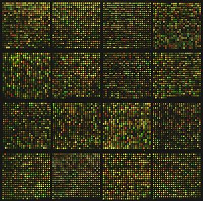 Análisis de mezcla espectral adaptativa para segmentación de lesiones metastásicas en tiempo real