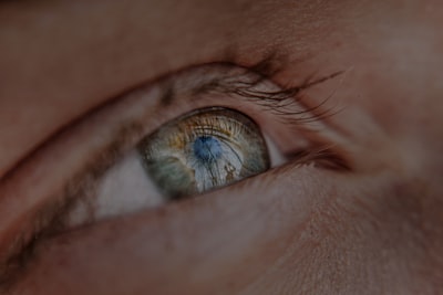 Editing Vision-Language Models with Human Reasoning