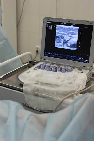 Análisis espectral para mantenimiento predictivo de dispositivos de asistencia ventricular