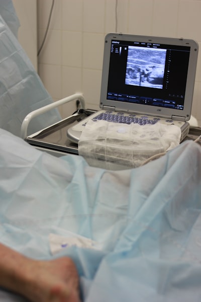 Segmentación Automatizada de la Cabeza Fetal con Atención-ResUNet