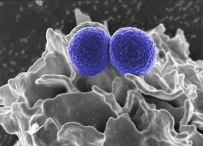 Mejora de la entrega de CRISPR-Cas en genoma microbiano con nanopartículas lipídicas