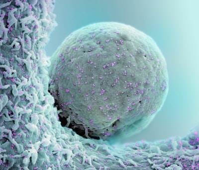 Identificación de marcadores de superficie en células madre cancerosas