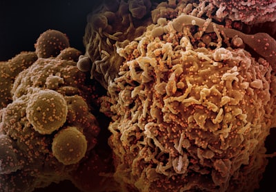 Clasificación de subtipos de cáncer de ovario mediante aprendizaje contrastivo y de prototipos