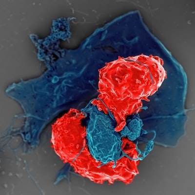 Fusión de datos multimodales y optimización bayesiana para búsqueda acelerada de anticuerpos