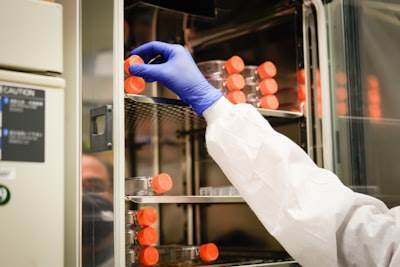 Optimización de Consortio Microbiano para Nutrientes en Sistemas SBR