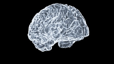 Optimización de segmentación tumoral sin reentrenar modelos