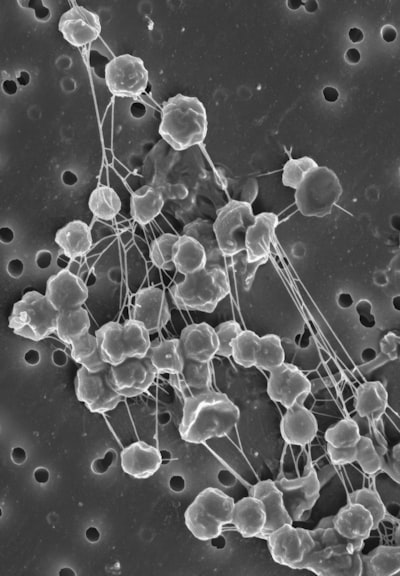 Protocolo NEXI reducido para cuantificar la microestructura de la materia gris humana en el escáner Connectome 2.0