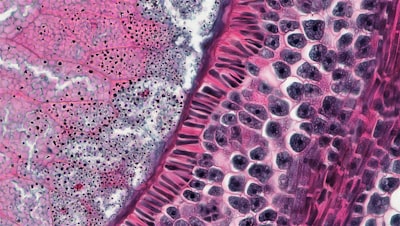Uniendo biología espacial e histología clínica con Haiku