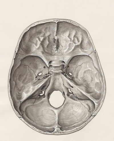 Mejora de la velocidad y desenrollado sin supervisión en MRI de flujo 4D con redes neuronales libres de divergencia