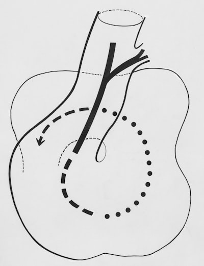Inferencia de Cópula Arquimediana con Diferenciación Automática Taylor