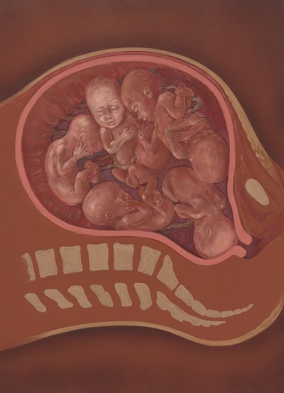 Detección de hipertensión materna mediante análisis jerárquico multivista de hemodinámica fetal