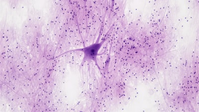 Decodificación visual neuronal con desenfoque adaptativo y alineación informacional