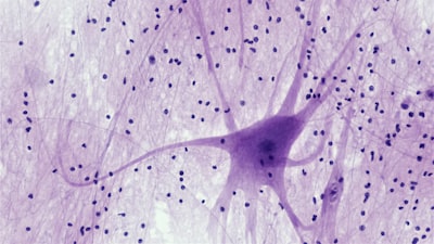 Búsqueda evolutiva de arquitecturas neuronales eficientes para segmentación de RM cardíaca