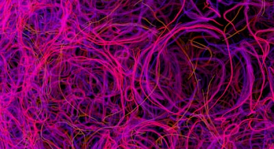Comparación de tuberías Neural Retriever-Reranker para Generación Mejorada por Recuperación en Grafos de Conocimiento eCommerce