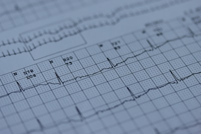 Mejora la robustez ante cambios de distribución en ECG