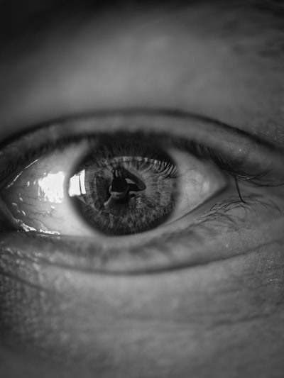 Sicofancia moral en modelos de visión de lenguaje