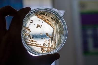 Optimización de consorcios microbianos para producción mejorada de bioplásticos