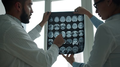 Extracción de cerebro eficiente en resonancia magnética con neuropatología leve a moderada