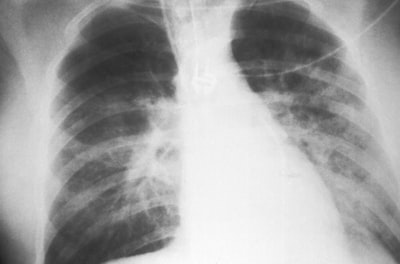 Medición y mitigación de toxicidad en LLMs: estudio de replicación